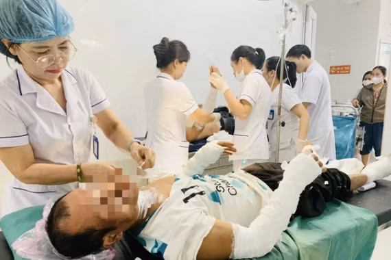 Thui thịt chó bằng bình gas, 2 người đàn ông bị bỏng nặng