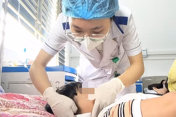 Bé 6 tuổi mang dị tật rò luân nhĩ di truyền qua 3 thế hệ
