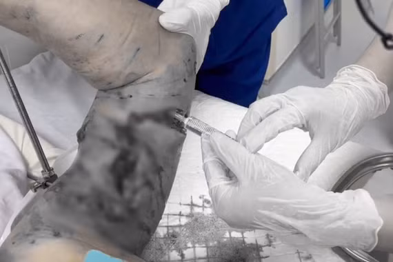 Chó becgie nặng hơn 30 kg tấn công chủ 72 tuổi gây tổn thương nghiêm trọng