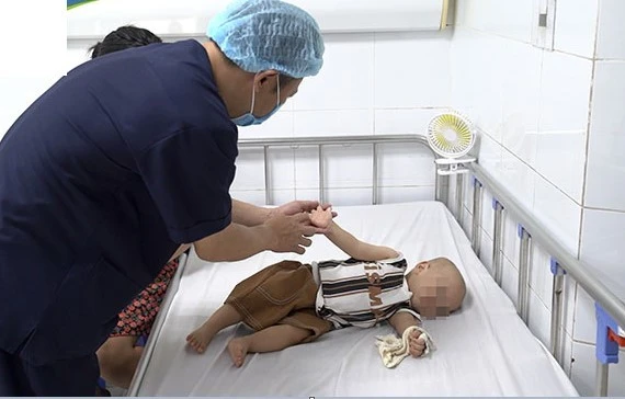 Bệnh tay chân miệng vào mùa, trẻ mắc lại nhiều lần, cha mẹ cần làm gì?