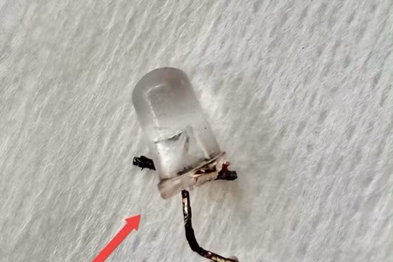 Thót tim xử trí cấp cứu bé 9 tháng tuổi sặc bóng đèn led vào phế quản