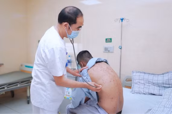 Nhiều người lớn mắc thủy đậu bội nhiễm, bác sĩ cảnh báo