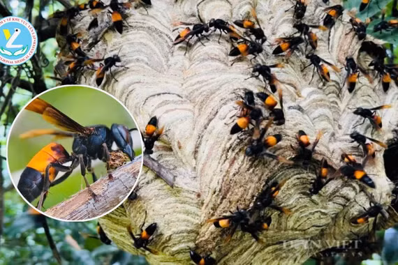 Ong đốt hàng trăm mũi, người bệnh suy đa cơ quan