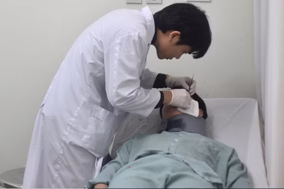  Cô gái 24 tuổi nhập viện vì áp xe sau tiêm filler tạo hình tai 3 năm