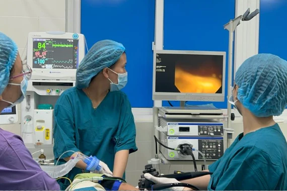 Đau cổ sau ăn cá, trẻ 6 tuổi bị xương cá mắc sau trụ amidan