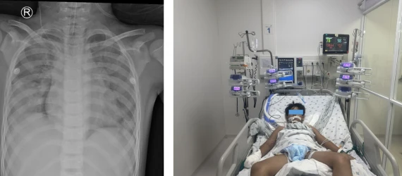 Nỗ lực cứu trẻ 10 tuổi đuối nước ngay tại hồ bơi