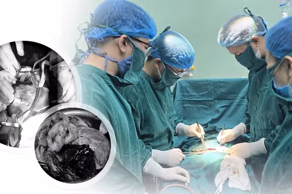 10 phút cứu sống sản phụ và thai nhi rau bong non 