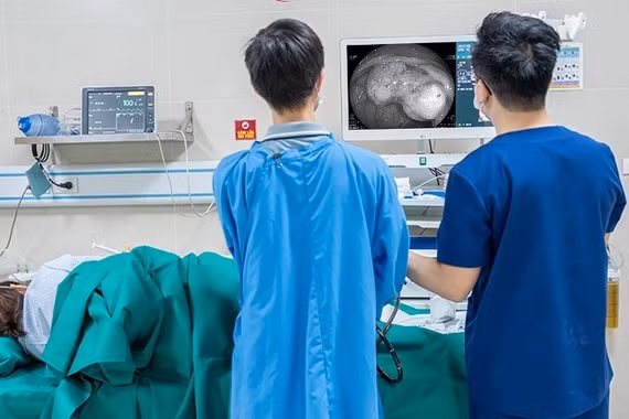 Tưởng rối loạn tiêu hóa do ăn uống không ngờ polyp đại tràng ung thư