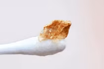 Nút ráy tai sau khi đi bơi dễ gây đau ù tai