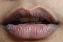 4 dấu hiệu trên cơ thể cảnh báo thận nam giới đang suy yếu