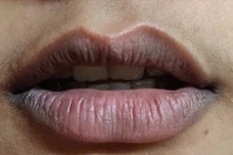 4 dấu hiệu trên cơ thể cảnh báo thận nam giới đang suy yếu