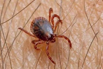 Ve rận chó ký sinh trong ống tai bệnh nhi 9 tuổi