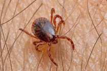 Ve rận chó ký sinh trong ống tai bệnh nhi 9 tuổi