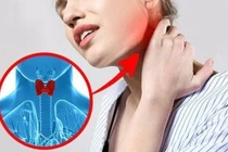 5 dấu hiệu cảnh báo tuyến giáp đang gặp vấn đề 