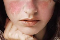 Thói quen vô tình làm da sạm nám nhanh hơn