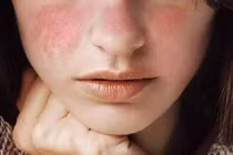 Thói quen vô tình làm da sạm nám nhanh hơn