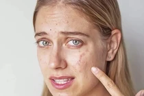 Thói quen xấu hàng ngày phá hủy làn da bạn không ngờ tới