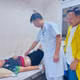 Đau bụng quanh rốn, hai trẻ nhập viện vì xương lợn đâm thủng ruột