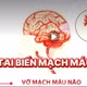 Bác sĩ mách cách dự phòng bệnh mạch vành do tăng huyết áp