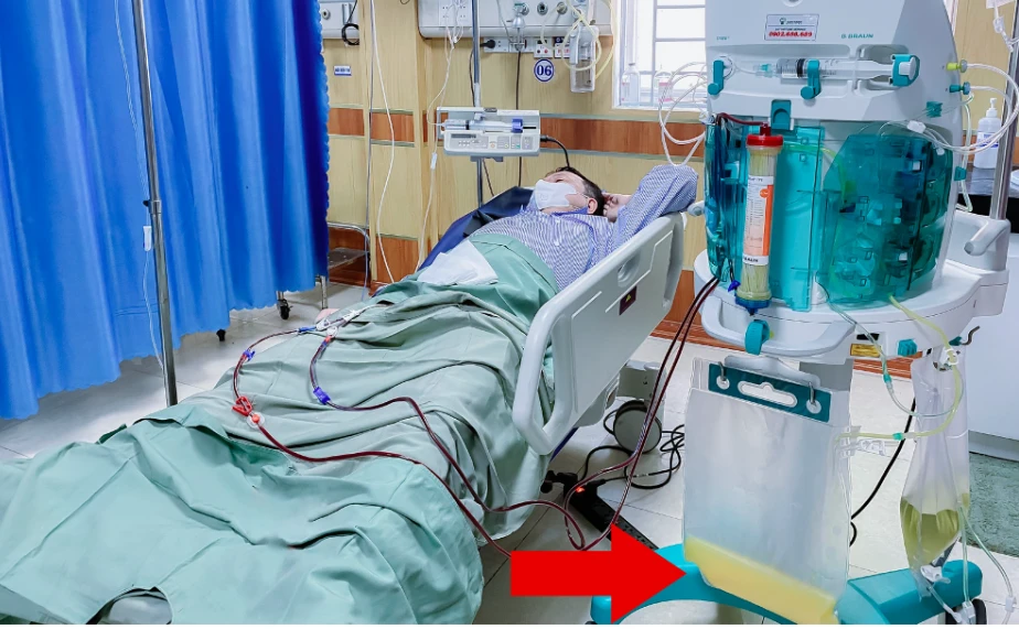 Khó thở, lừ đừ cụ bà 88 tuổi nguy kịch vì tăng Kali máu