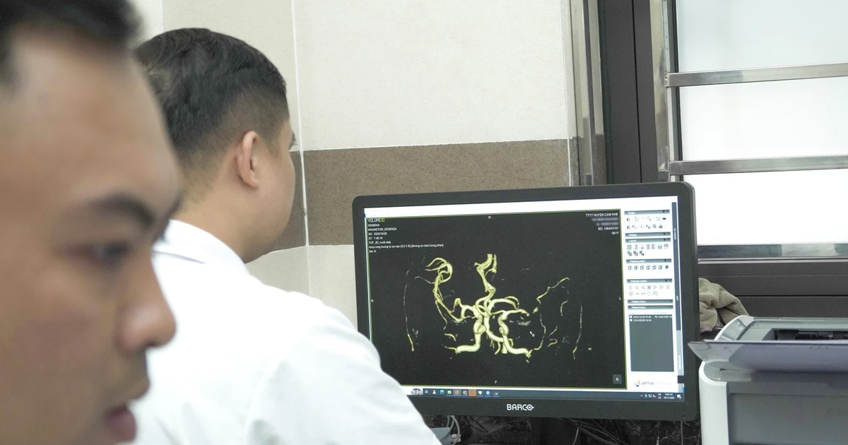 Chậm trễ trong điều trị đột quỵ, nguy cơ tử vong, di chứng nặng