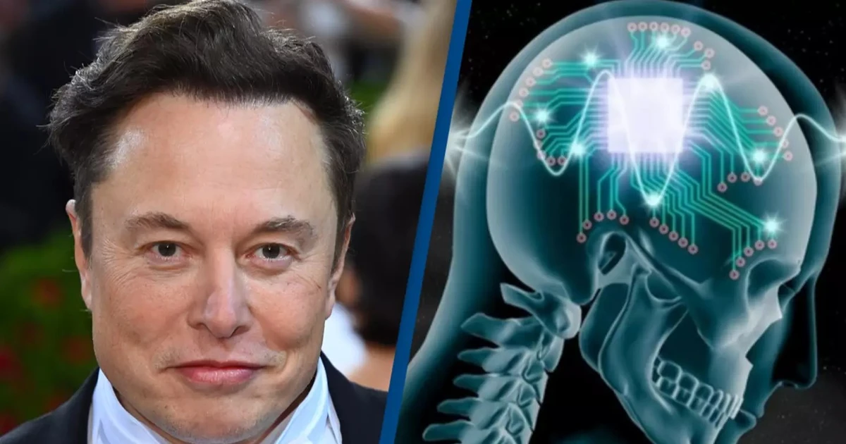 Neuralink của Elon Musk lập kỷ lục cấy chip não 1,5 giây