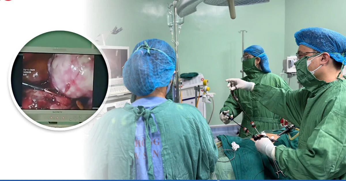 Phẫu thuật nội soi bóc u xơ tử cung lớn kèm dính ruột ở phụ nữ 46 tuổi