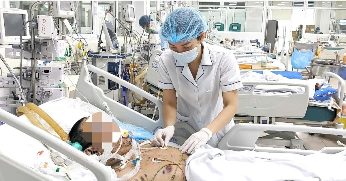 Lây thủy đậu từ con gái, người đàn ông 36 tuổi nguy kịch vì viêm phổi ARDS