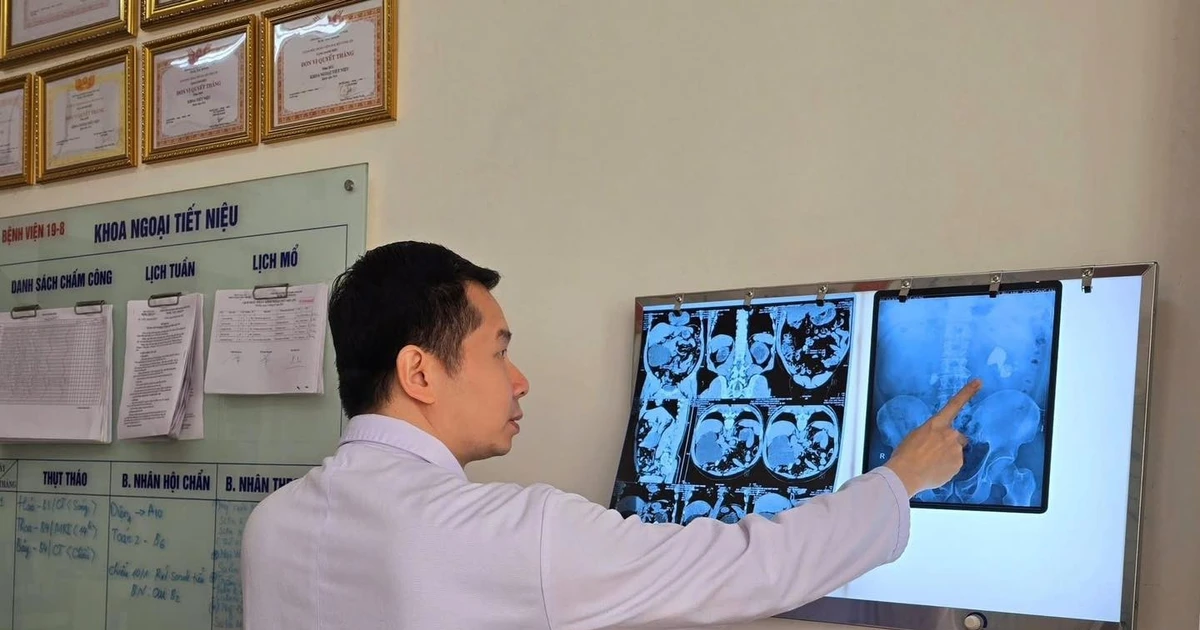Chủ quan sỏi thận không đau, không điều trị, người bệnh bị suy thận nặng