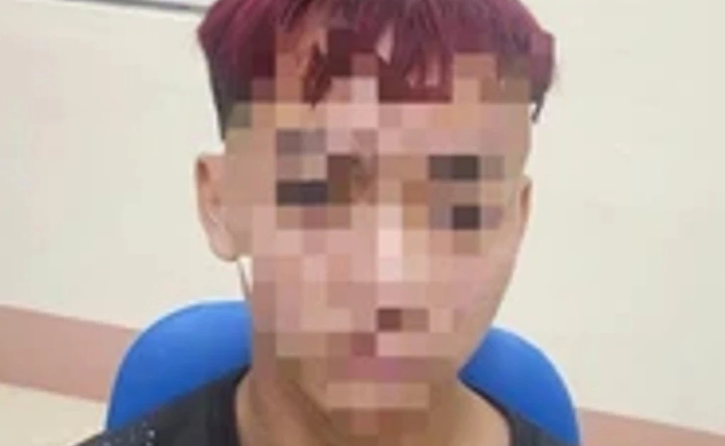 Thiếu niên 15 tuổi hiếp dâm bé 12 tuổi ở Lào Cai sẽ bị xử lý ra sao?