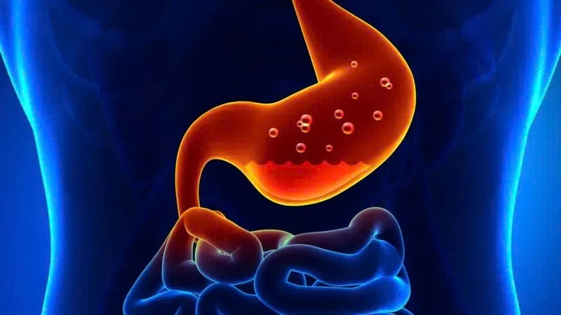 Thay đổi thói quen hàng ngày giúp kiểm soát axit dạ dày hiệu quả