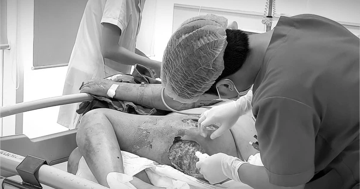 Tự chích mụn, cụ ông sốc nhiễm trùng huyết, hoại tử vùng mông đùi