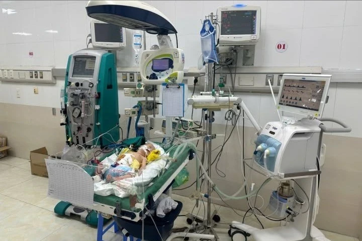 Trẻ 3 ngày tuổi chướng bụng do thủng ruột, viêm phúc mạc