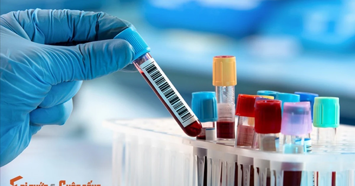 [Infographic] Các xét nghiệm định kỳ quan trọng để bảo vệ sức khỏe