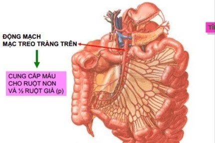 Chữa thành công bệnh hiếm gây tắc nghẽn ruột bằng phẫu thuật tại TP HCM