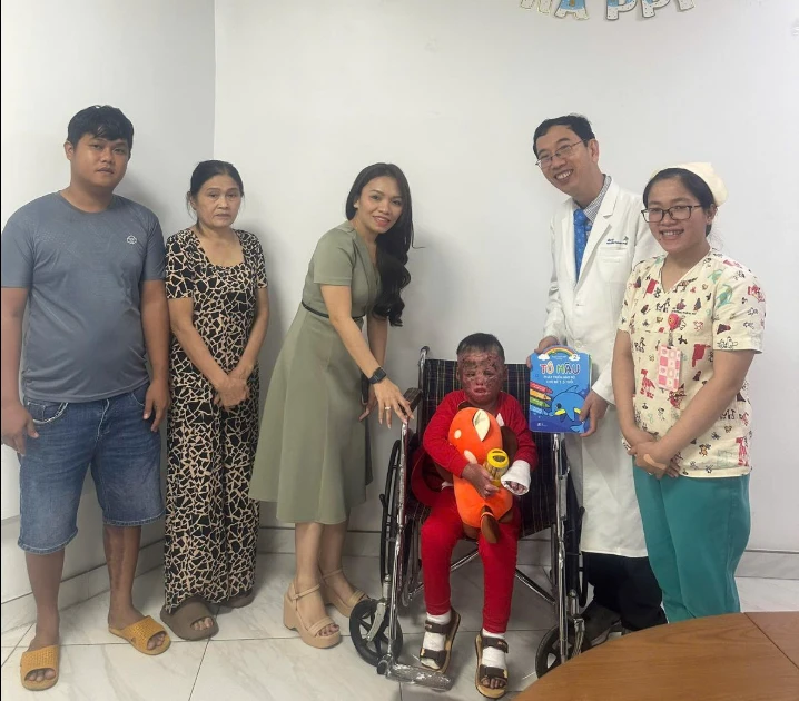 Hành trình 96 ngày điều trị cho trẻ 5 tuổi bị cha đốt xăng bỏng 80%