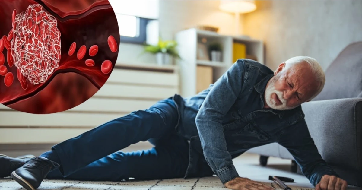 Nguy cơ ngã ở người cao tuổi, thuốc chống huyết khối có còn phù hợp?