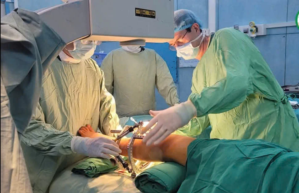 Kéo dài chi cho trẻ bị thiểu xương mác cải thiện dáng đi