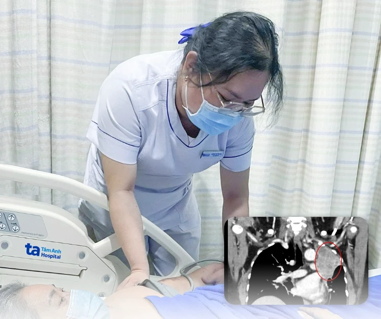 Tưởng đột quỵ đi khám không ngờ ung thư phổi di căn não