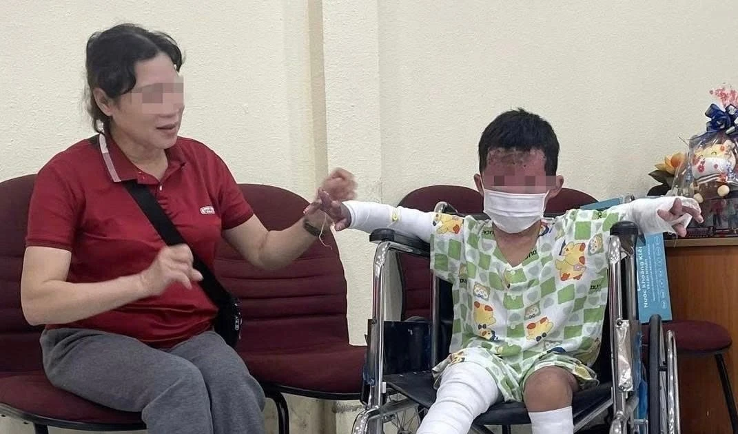 Chữa bỏng cho bé trai duy nhất sống sót trong vụ cháy nhà tại An Khê, Gia Lai