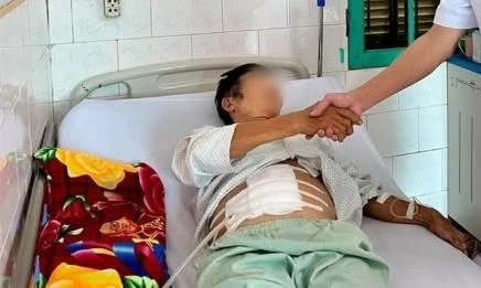 Cứu sống bệnh nhân bị thủng túi thừa ruột non, đại tràng gây áp xe nặng