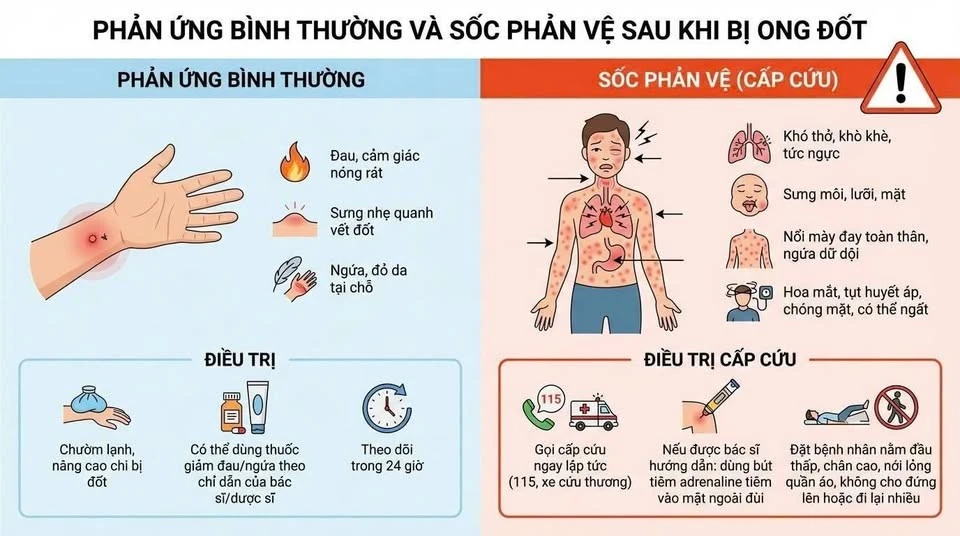 Cưu sống bệnh nhân ở Tuyên Quang sốc phản vệ do bị ong đốt