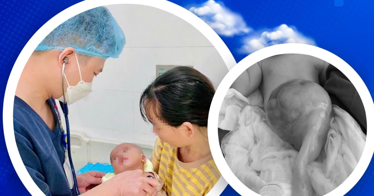 Hồi phục kỳ diệu của bé sơ sinh thoát vị rốn lớn nhất từ trước tới nay