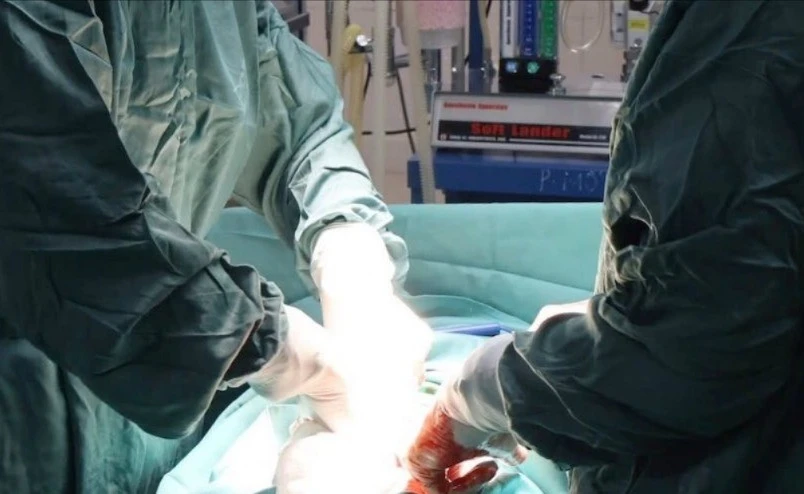 Điều trị thành công ung thư buồng trứng hiếm gặp ở trẻ em