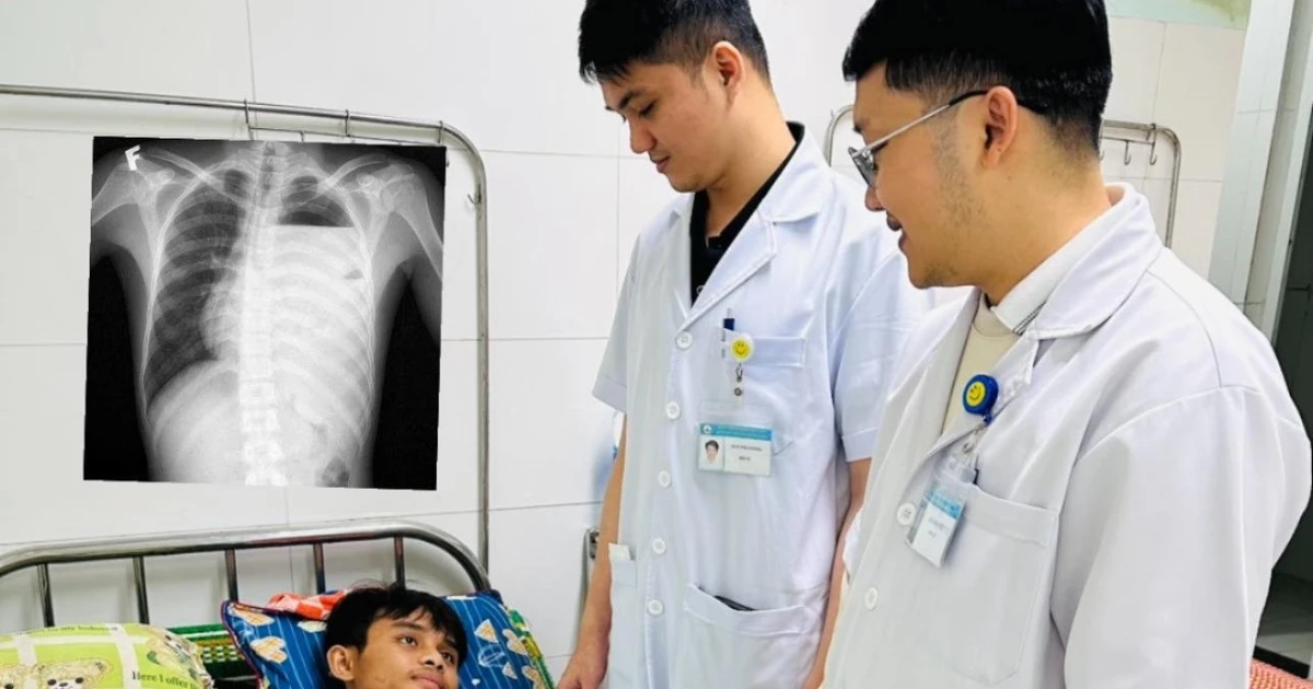 Đau ngực trái, thanh niên 20 tuổi nguy kịch vì tràn mủ, tràn khí màng phổi