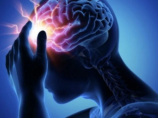 Phẫu thuật giúp người phụ nữ thoát khỏi nỗi đau nửa đầu kéo dài 20 năm