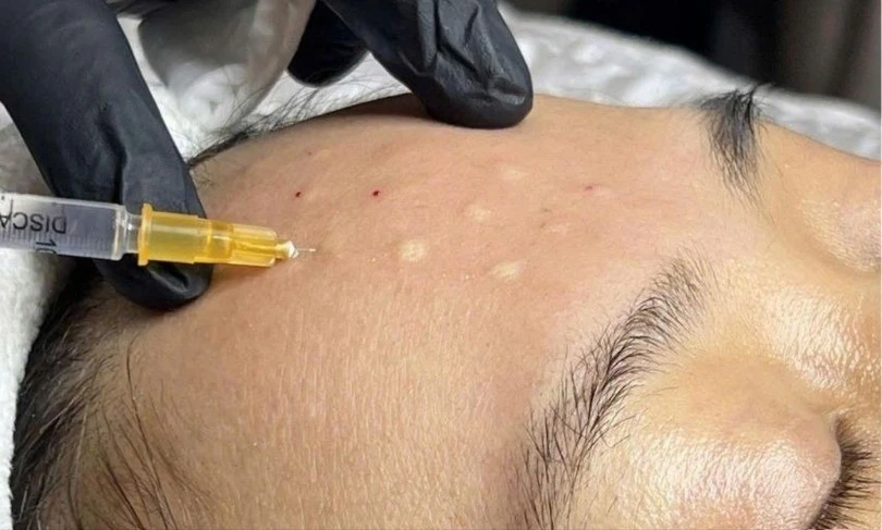 Phân biệt dịch vụ thẩm mỹ phi y tế để tránh rủi ro sức khỏe