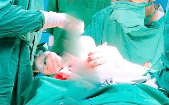 Phẫu thuật ghép sọ thành công cho bệnh nhân 15 tuổi tại Quảng Ninh