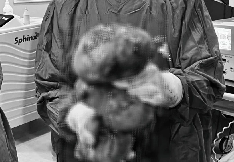 Nỗi khổ của người phụ nữ mang khối u xở tử cung to như thai 9 tháng