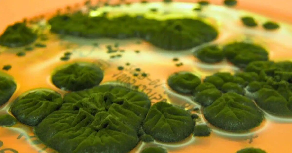 Nấm đen kỳ lạ của Chernobyl có thể chống lại bức xạ?